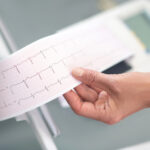 בדיקת א.ק.ג ביתית