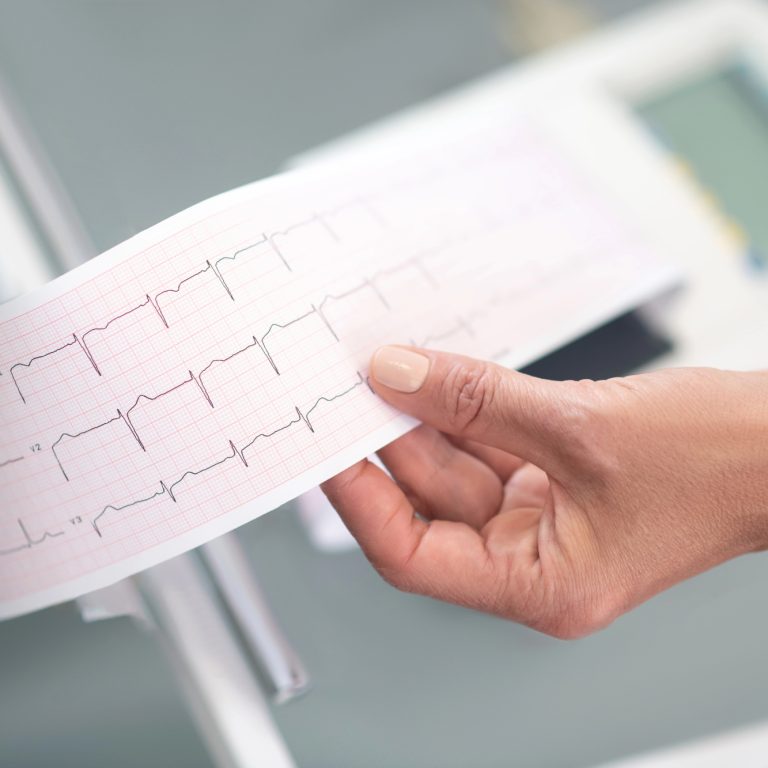 בדיקת א.ק.ג ביתית